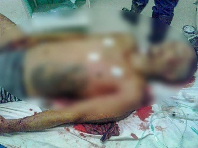 Homem é assassinado com seis tiros no Mirim em Madre de Deus, afirma a polícia