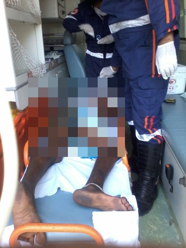 CANDEIAS: HOMEM EM SITUAÇÃO DE RUA É QUEIMADO NO CENTRO DA CIDADE