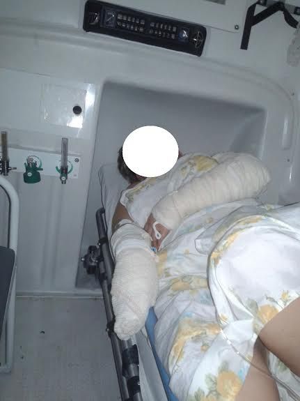 SÃO S. DO PASSÉ: EX-VEREADOR E COMPARSA SÃO CONDENADOS POR JOGAR ÁCIDO EM EX-CUNHADA