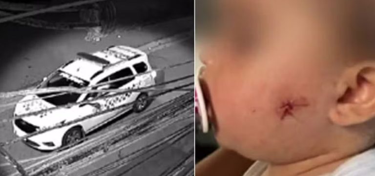 Policial Militar atira em rosto de criança de 1 ano com arma de airsoft, em São Paulo