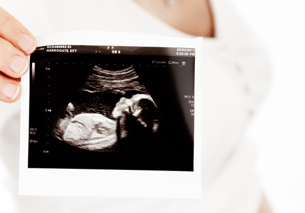 Proposta que penaliza quem vender abortivos é aprovada em comissão