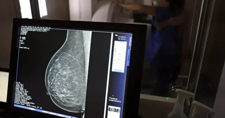 Ministério da Saúde passa a recomendar mamografia a partir dos 40 anos