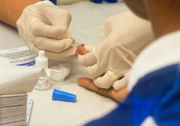 Saúde disponibiliza testes rápidos para ISTs em postos estratégicos do Carnaval